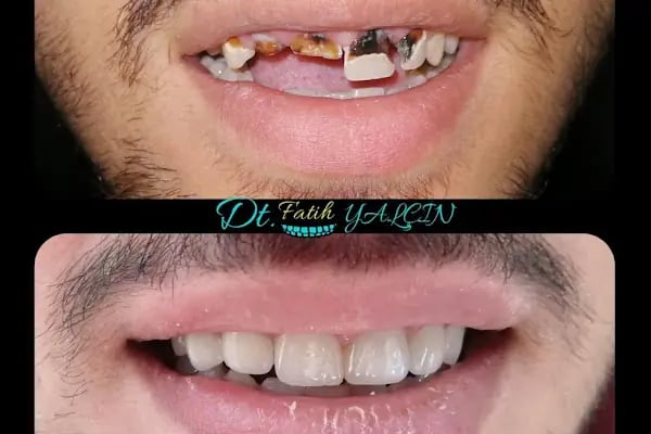 Özel Doğa Dent Ağız ve Diş Sağlığı Polikliniği Gaziantep - Resim 19