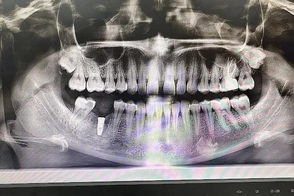 Denta Nora Ağız Ve Diş Sağlığı Polikliniği - Resim 4