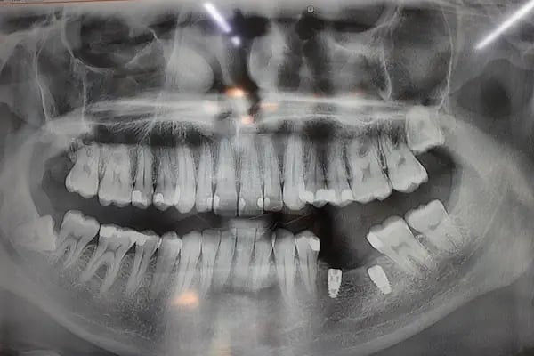 Denta Nora Ağız Ve Diş Sağlığı Polikliniği - Resim 5