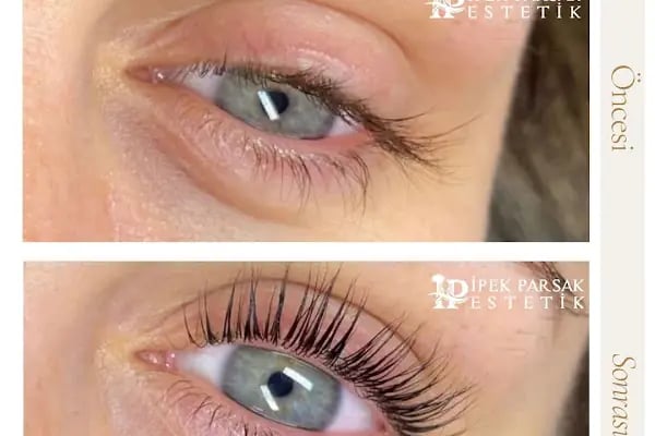 İpek Parsak Güzellik Merkezi - Diode Lazer Epilasyon - Hydrafacial Cilt Bakımı - Resim 7