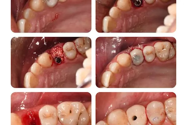 MAYA Dental Klinik - Resim 12