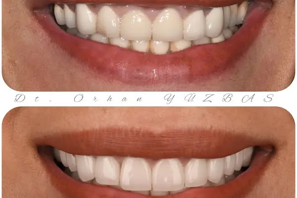 MAYA Dental Klinik - Resim 15
