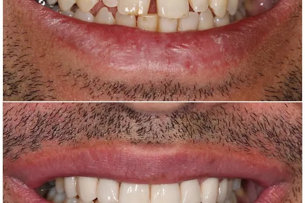 MAYA Dental Klinik - Resim 11
