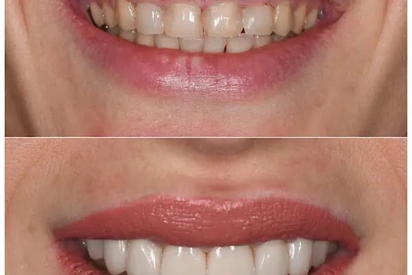 MAYA Dental Klinik - Resim 9