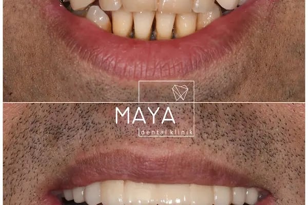 MAYA Dental Klinik - Resim 18