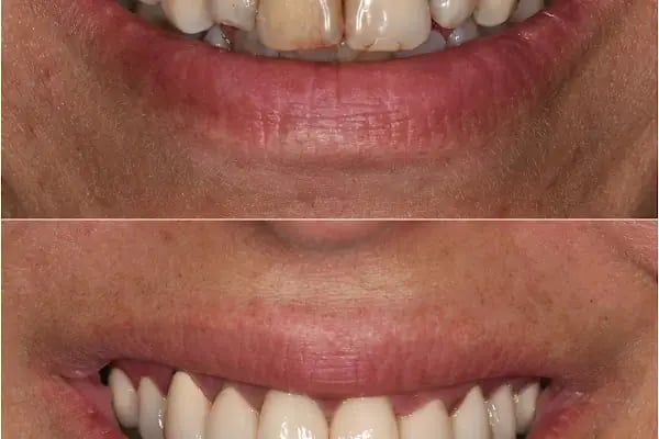 MAYA Dental Klinik - Resim 20