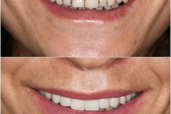 MAYA Dental Klinik - Resim 10