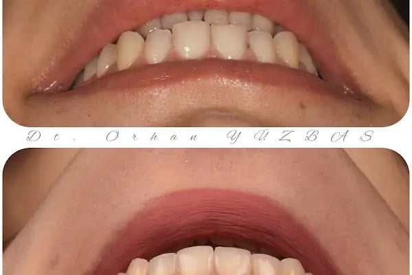 MAYA Dental Klinik - Resim 19