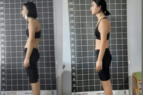 Eforfiz Sağlıklı Yaşam Merkezi - Resim 18