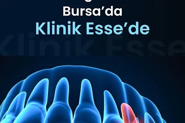 Klinik Esse Ağız ve Diş Sağlığı Polikliniği - Davutdede - Resim 16