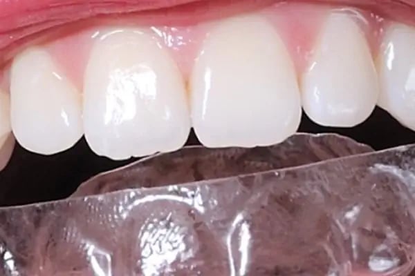 Doktordiş Ağız ve Diş Sağlığı Polikliniği - Resim 8