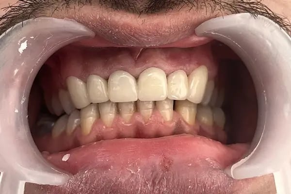 Amelas Dent Ağız ve Diş Sağlığı Polikliniği - Resim 7