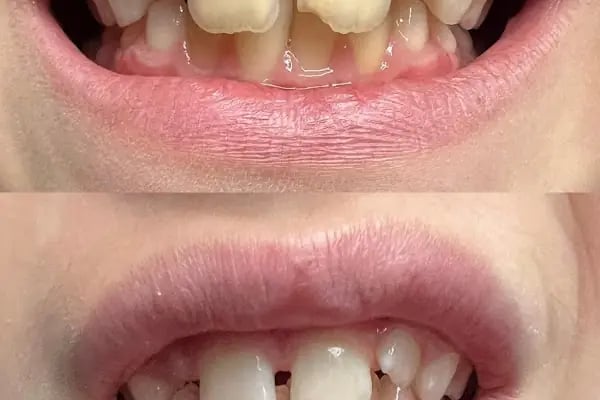 Dentyalıkavak Ağız Ve Diş Sağlığı Polikliniği - Resim 14