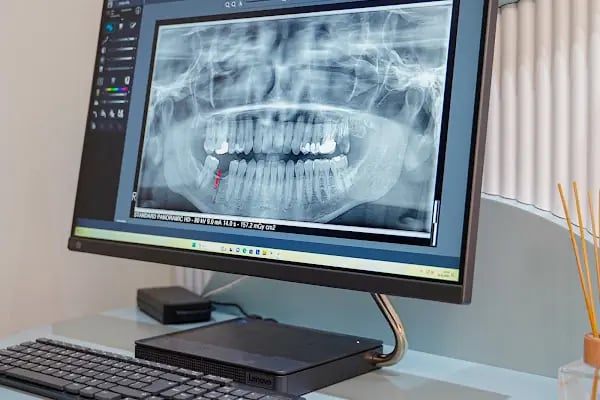 Dentyalıkavak Ağız Ve Diş Sağlığı Polikliniği - Resim 13