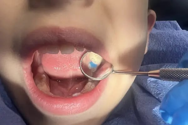 Dentyalıkavak Ağız Ve Diş Sağlığı Polikliniği - Resim 16