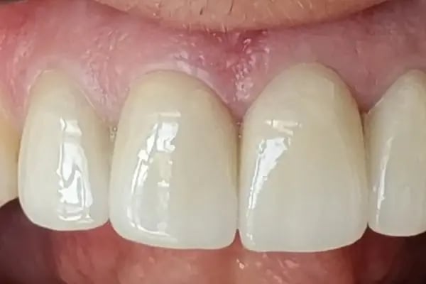 Diş hekimi Mehmet ÖZER-Alanya Diş hekimi -Diş kliniği-İmplant -Zirkonyum-Acil Diş-Kanal Tedavisi-Porselen kaplama-Dentist- - Resim 18