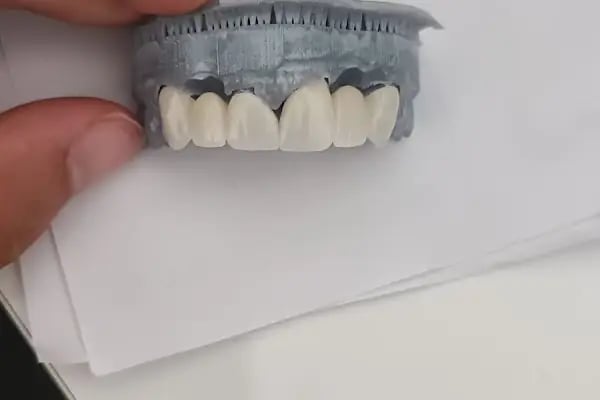 Diş hekimi Mehmet ÖZER-Alanya Diş hekimi -Diş kliniği-İmplant -Zirkonyum-Acil Diş-Kanal Tedavisi-Porselen kaplama-Dentist- - Resim 8