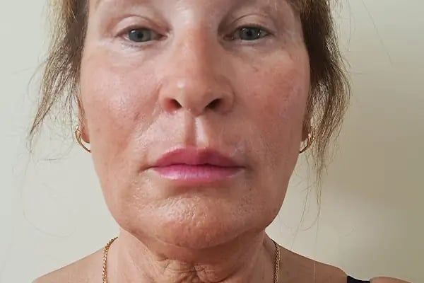 Clinic Result - Resim 3