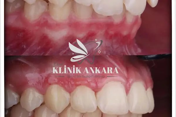 KLİNİK ANKARA AĞIZ VE DİŞ SAĞLIĞI POLİKLİNİĞİ - Resim 9