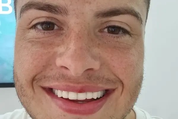 Alanya dental esthetic clinic Dt Burak Balçık - Resim 6