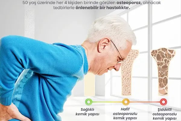 Op. Dr. Ozan Akca, Ortopedi Ve Travmatoloji - Resim 9