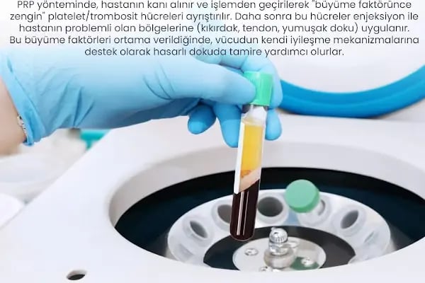 Op. Dr. Ozan Akca, Ortopedi Ve Travmatoloji - Resim 5