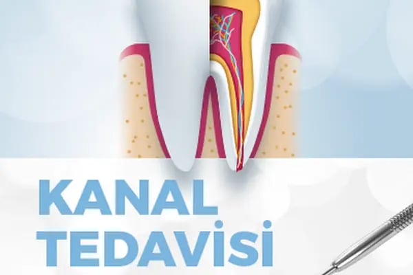 Uzunçarşı Diş Polikliniği - Resim 15