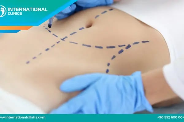 International Clinics - Resim 16