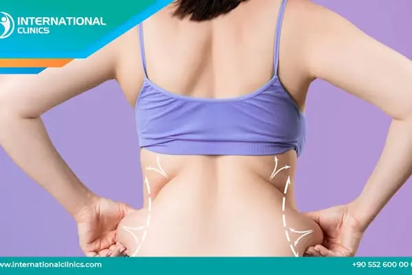 International Clinics - Resim 6