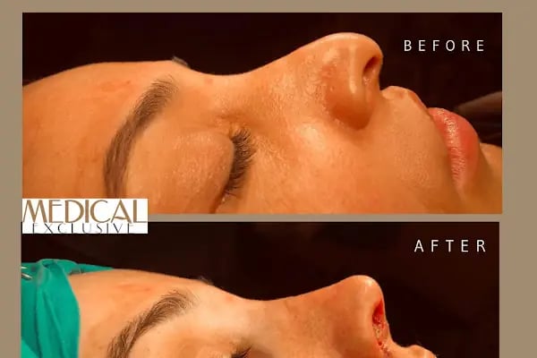 Medical Exclusive Istanbul - Resim 4