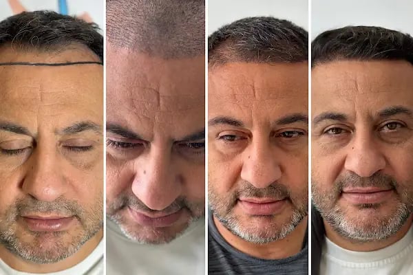 Clean Hair Diyarbakır - Resim 7