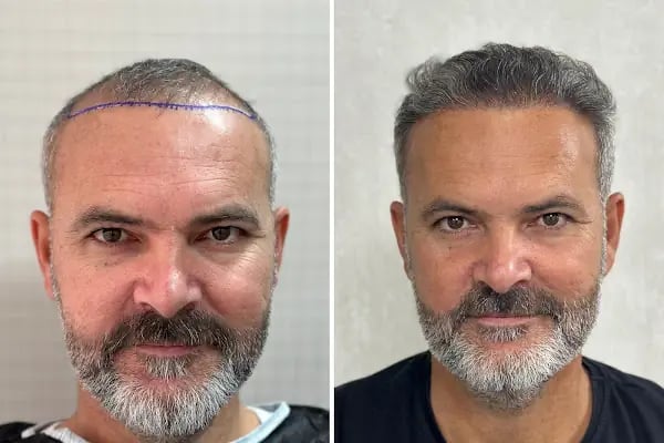 Clean Hair Diyarbakır - Resim 5