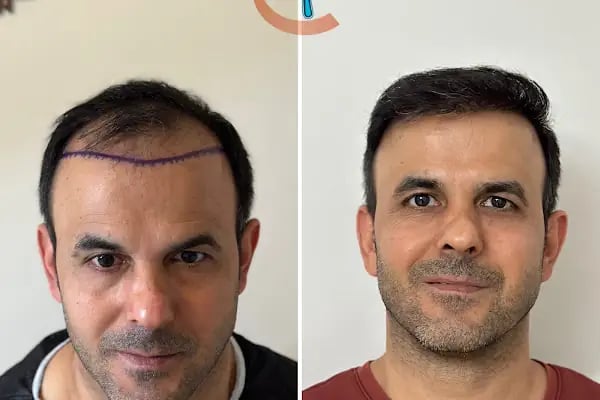 Clean Hair Diyarbakır - Resim 9