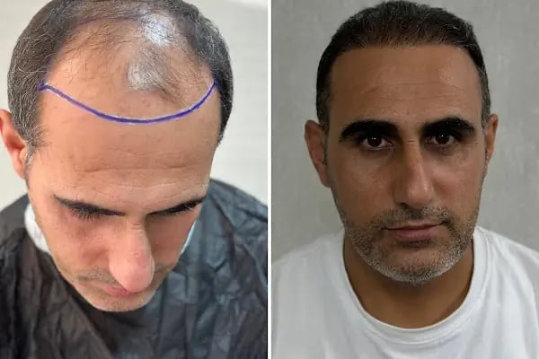 Clean Hair Diyarbakır - Resim 3