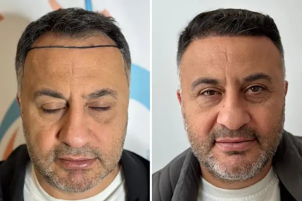 Clean Hair Diyarbakır - Resim 4