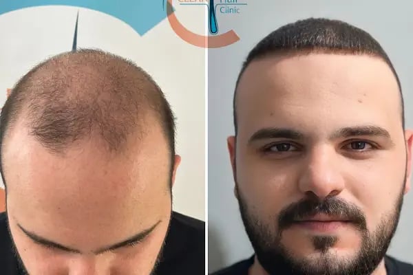 Clean Hair Diyarbakır - Resim 10