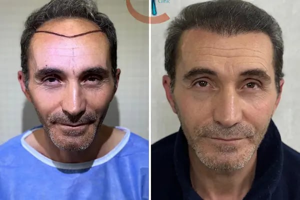 Clean Hair Diyarbakır - Resim 8