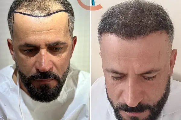 Clean Hair Diyarbakır - Resim 2