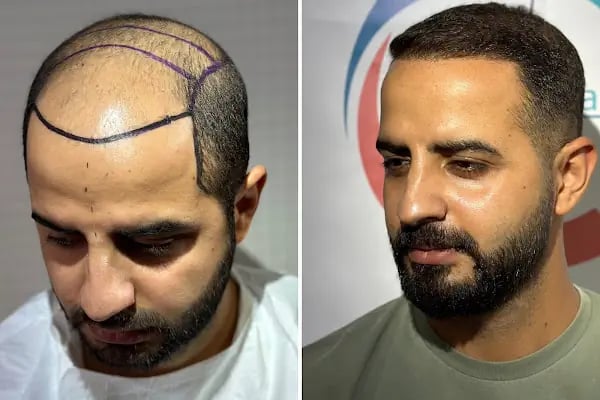 Clean Hair Diyarbakır - Resim 6