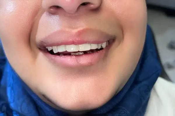 Nöbetçi Dişçi Bağcılar | Özel Bağcılar Güleryüz Diş Kliniği - Resim 18