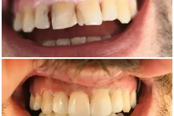 YASEMİN ASLIM Diş Hekimi - Resim 11