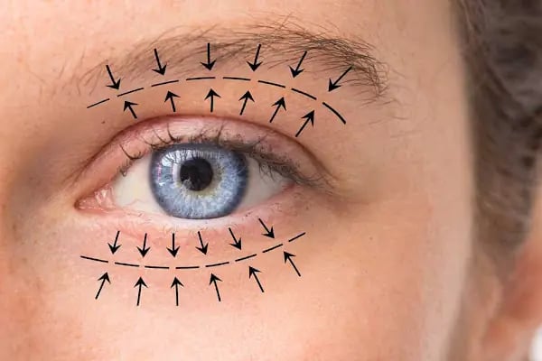 Uzm. Dr. İrem Hengirmen Acu | Dermatoloji &amp; Kozmetoloji &amp; Otolog Mikrogreft - Resim 3