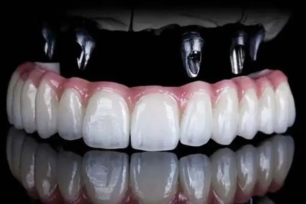 Dişhekimi Güngör ÇALIŞKAN İNNALI - Resim 16