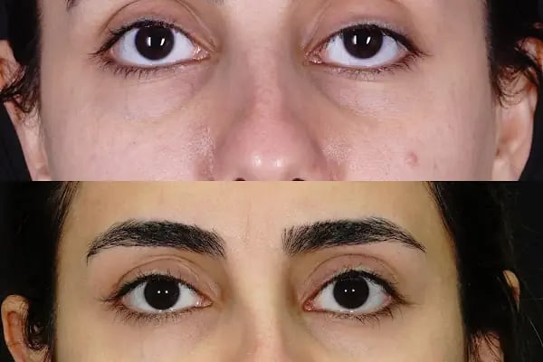 Op. Dr. Mert DEMİREL - Resim 19