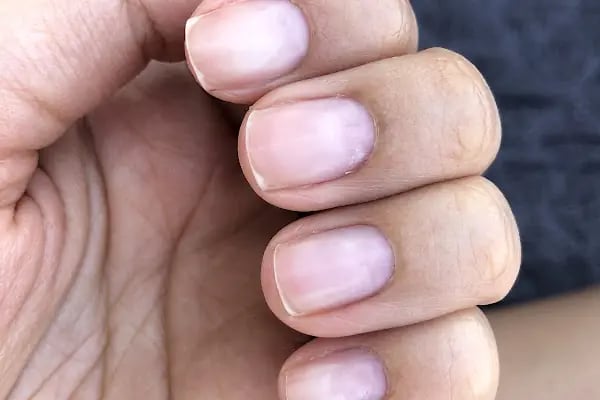 Miu Beauty Clinic - Resim 8