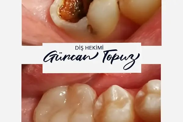 Diş Hekimi Gürcan Topuz - Resim 9