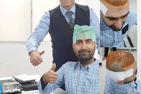 Gaziantep Saç Ekim - Fue Saç Ekim Merkezi fueestetik - Resim 9