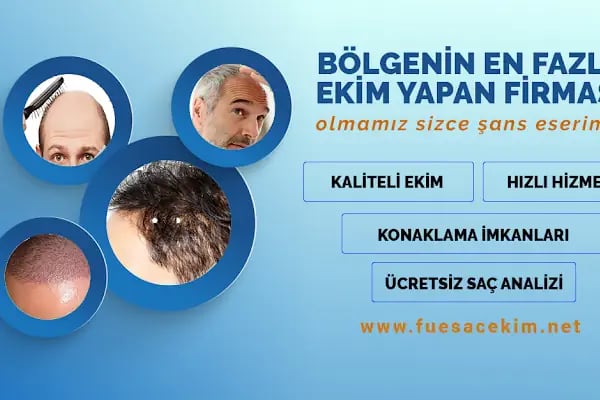 Gaziantep Saç Ekim - Fue Saç Ekim Merkezi fueestetik - Resim 15