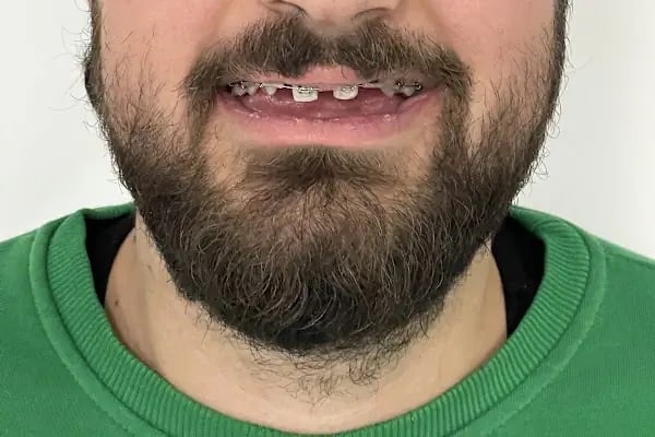 Özel Kanat Ağız ve Diş Sağlığı Polikliniği - Resim 4