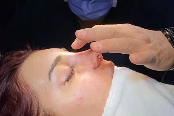 Op Dr Aytekin YAZ KBB - Resim 1